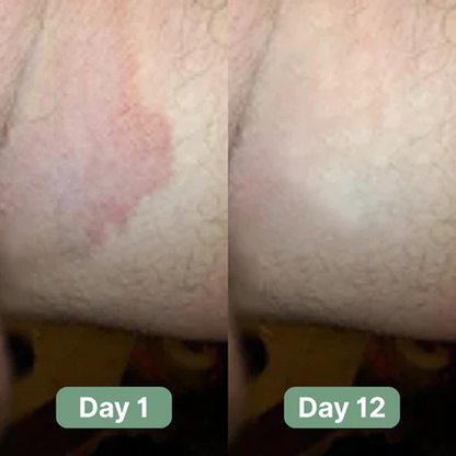 Ryan’s Antifungal Soap